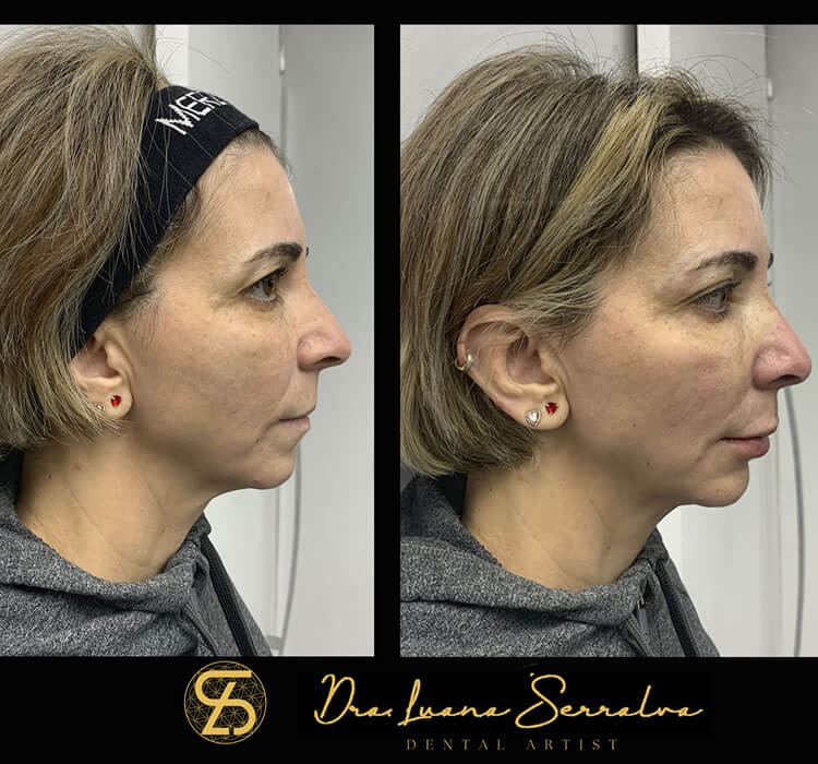 Mandíbula Dra. Luana Serralva